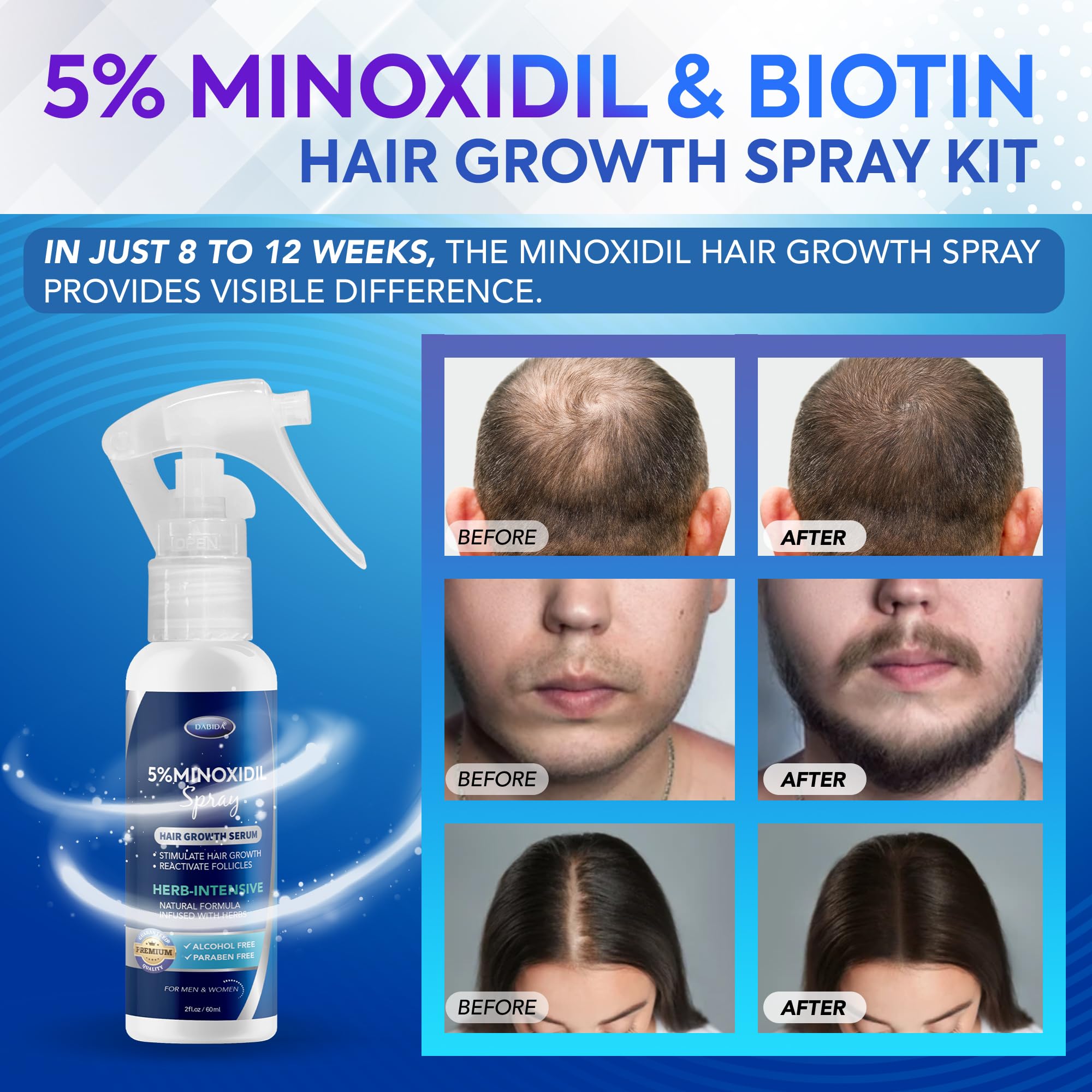 DABIDA Minoxidil spray con aplicador preciso para una aplicación diaria.
