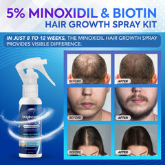 DABIDA Minoxidil spray con aplicador preciso para una aplicación diaria.