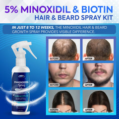 DABIDA Minoxidil spray application demonstrates easy daily use.