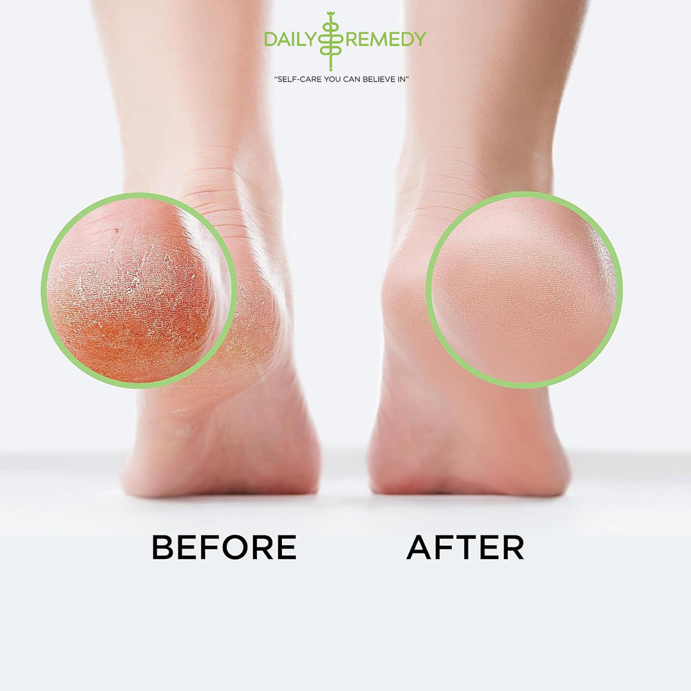 Daily Remedy aromaterapia con aceites para remojo de pies.