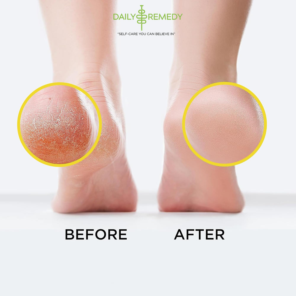 Daily Remedy Citrus Detox Foot Soak, sales Epsom y aceites para piel suave de pies