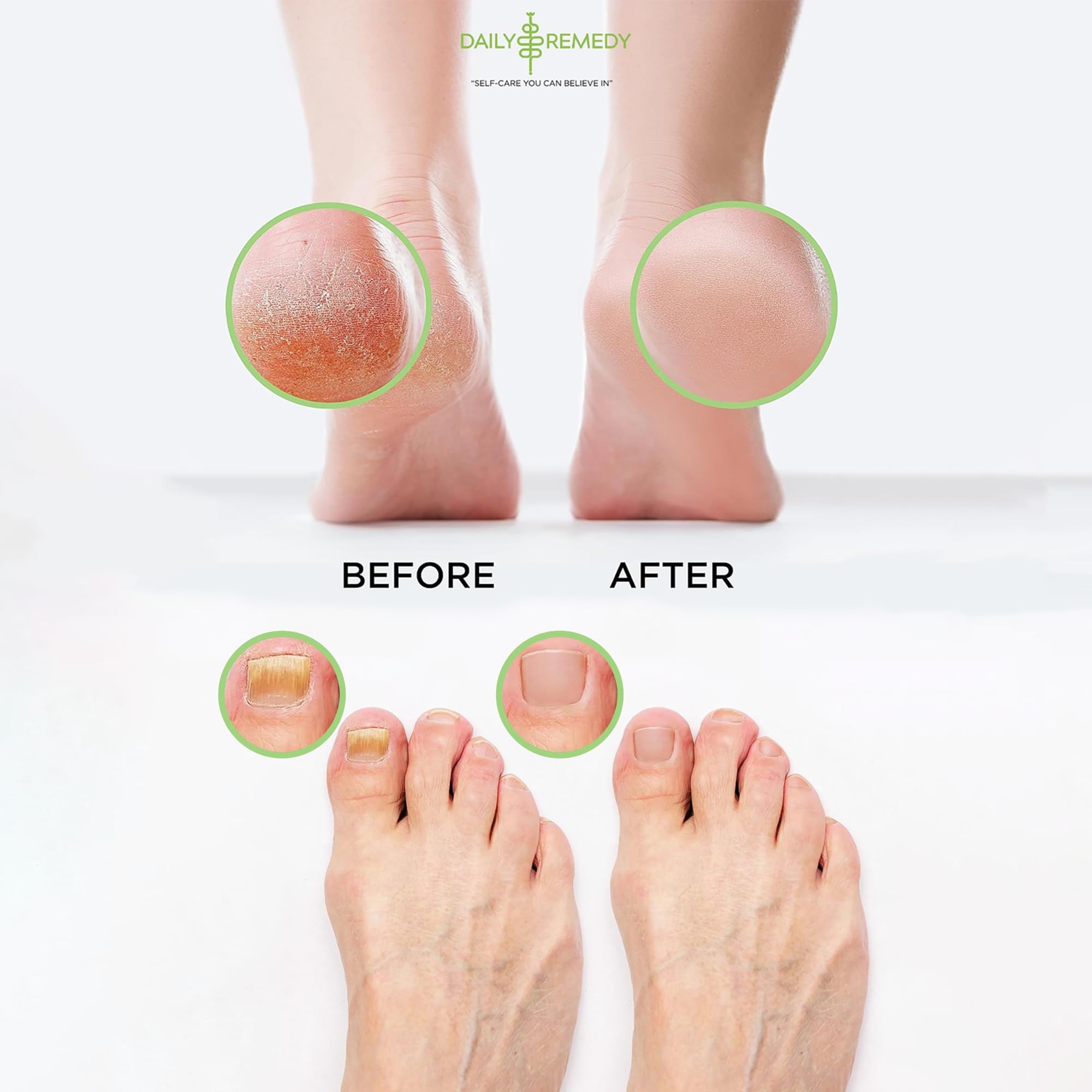 Daily Remedy Foot Soak hidratación para pies: suaviza callos y piel suave.