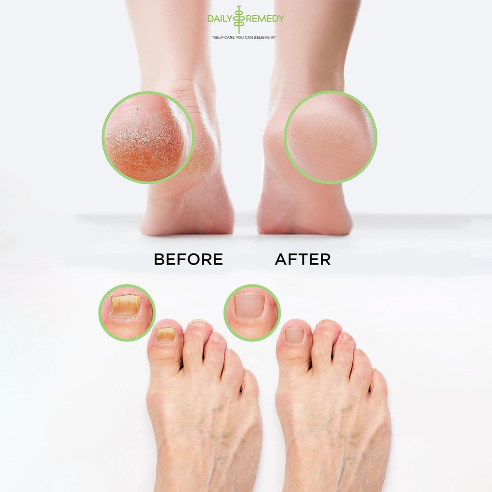 Daily Remedy Foot Soak hidratación para pies: suaviza callos y piel suave.