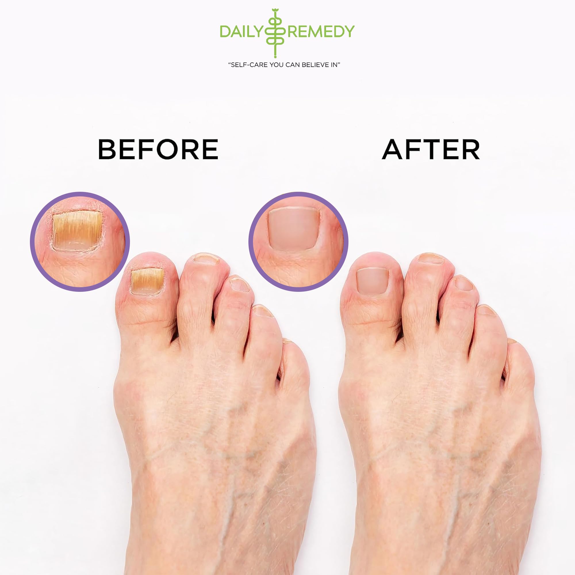  Daily Remedy Aroma herbal para refrescar los pies