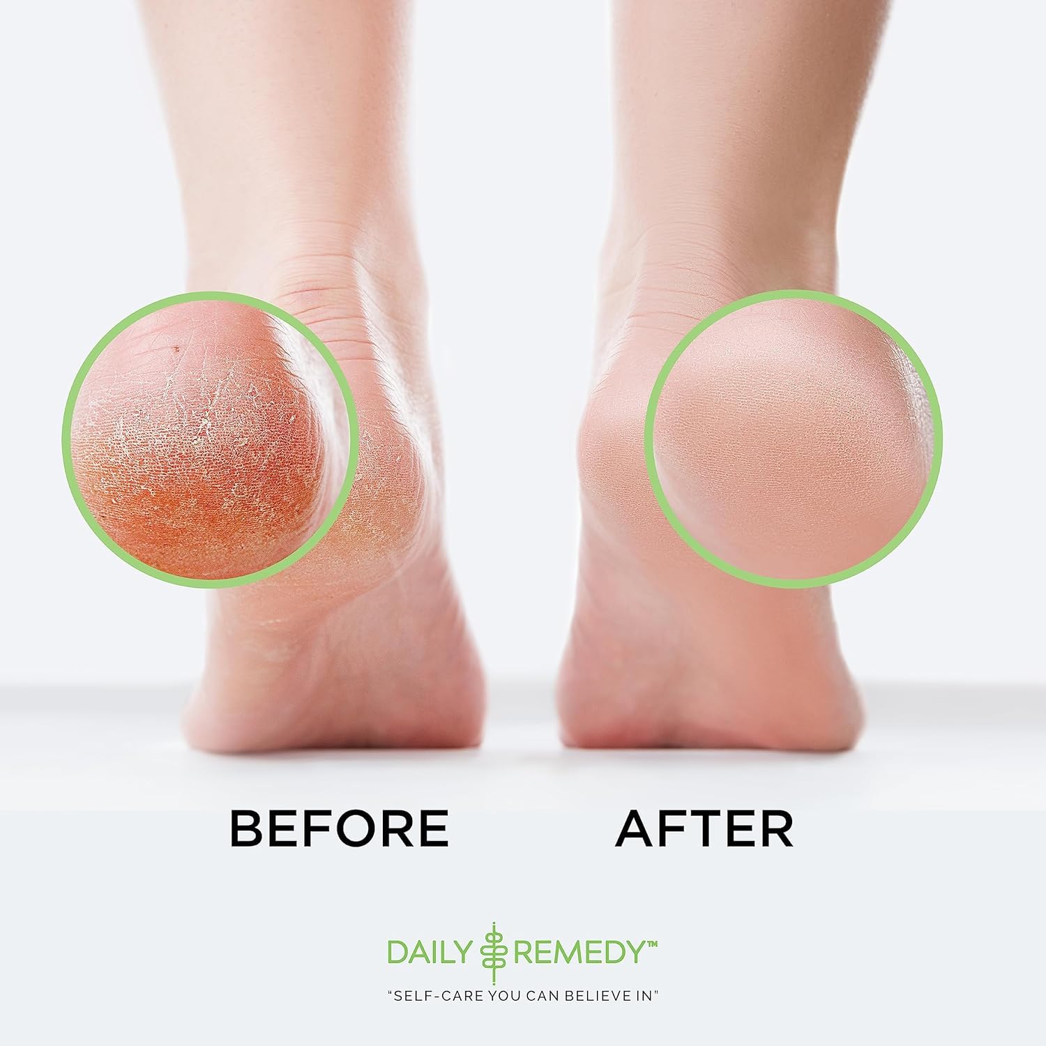 Daily Remedy escena casera de pedicure para cuidado en casa