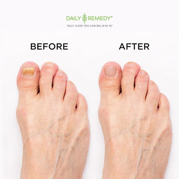 Daily Remedy pies relajados tras remojo tibio