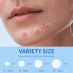 Daolyo parches acne 12mm cobertura discreta en la piel