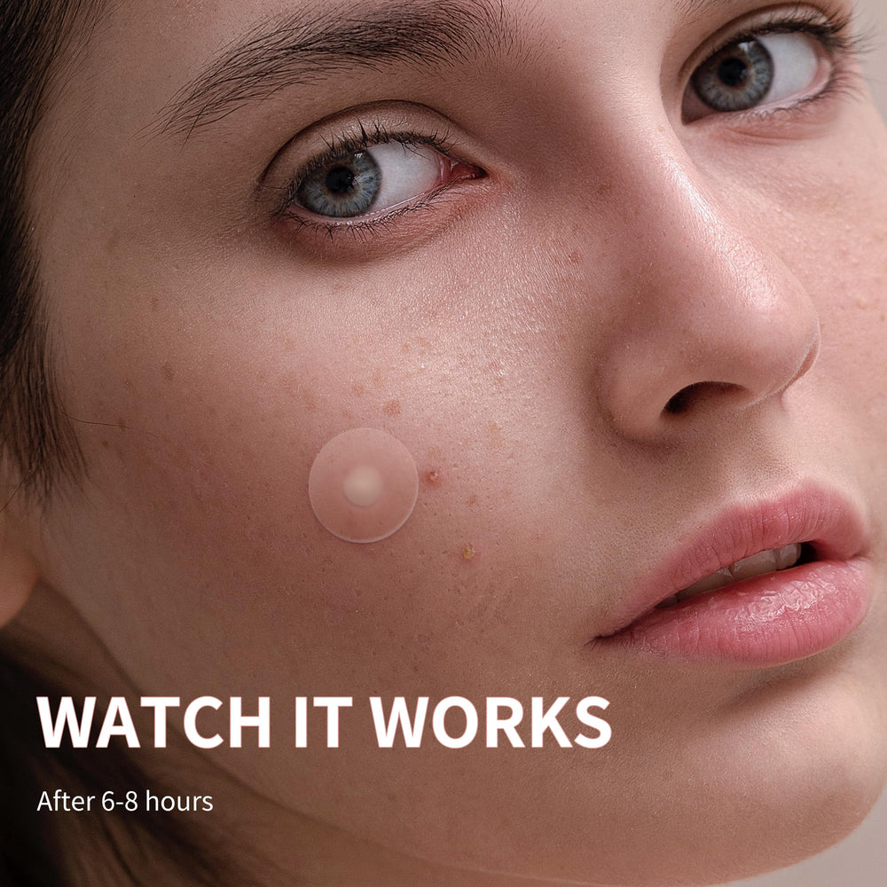 Daolyo parches acne 14mm para zonas más grandes