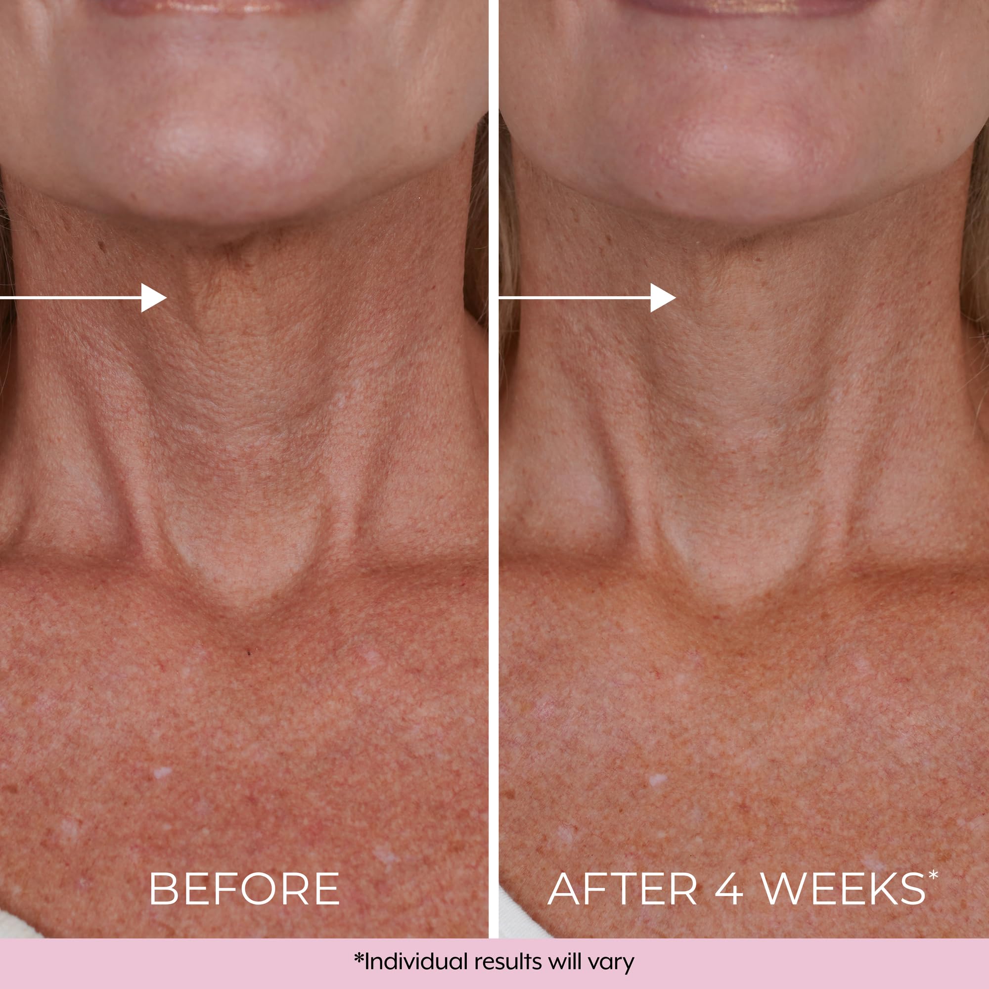 DEKLIDERM crema cuello efecto firmeza: sensación de levantamiento suave.