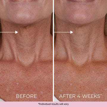 DEKLIDERM crema cuello efecto firmeza: sensación de levantamiento suave.
