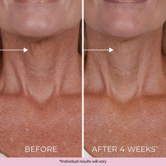 DEKLIDERM crema cuello efecto firmeza: sensación de levantamiento suave.