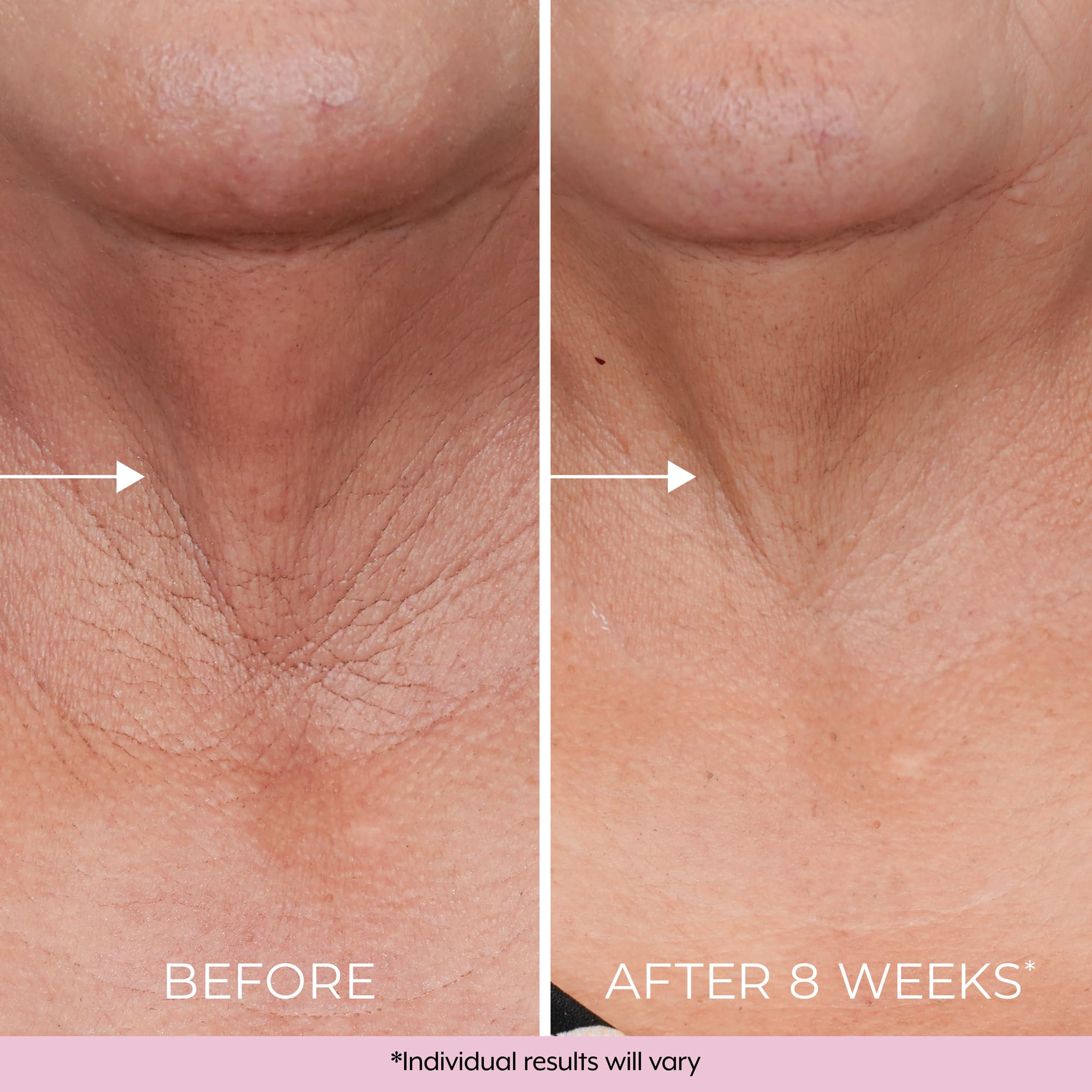 DEKLIDERM ingredientes retinol bakuchiol: cuidado de piel con resultados suaves.