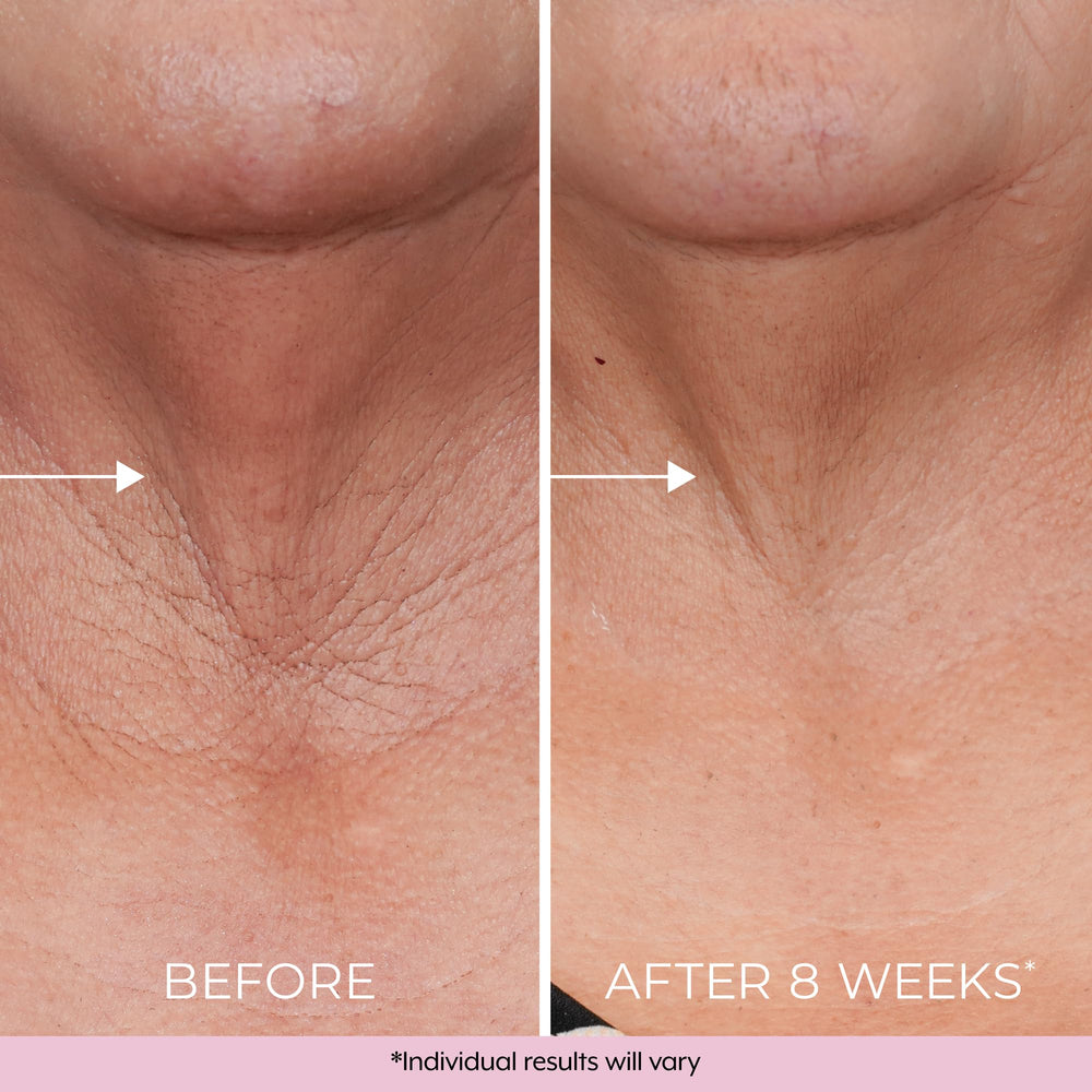 DEKLIDERM ingredientes retinol bakuchiol: cuidado de piel con resultados suaves.