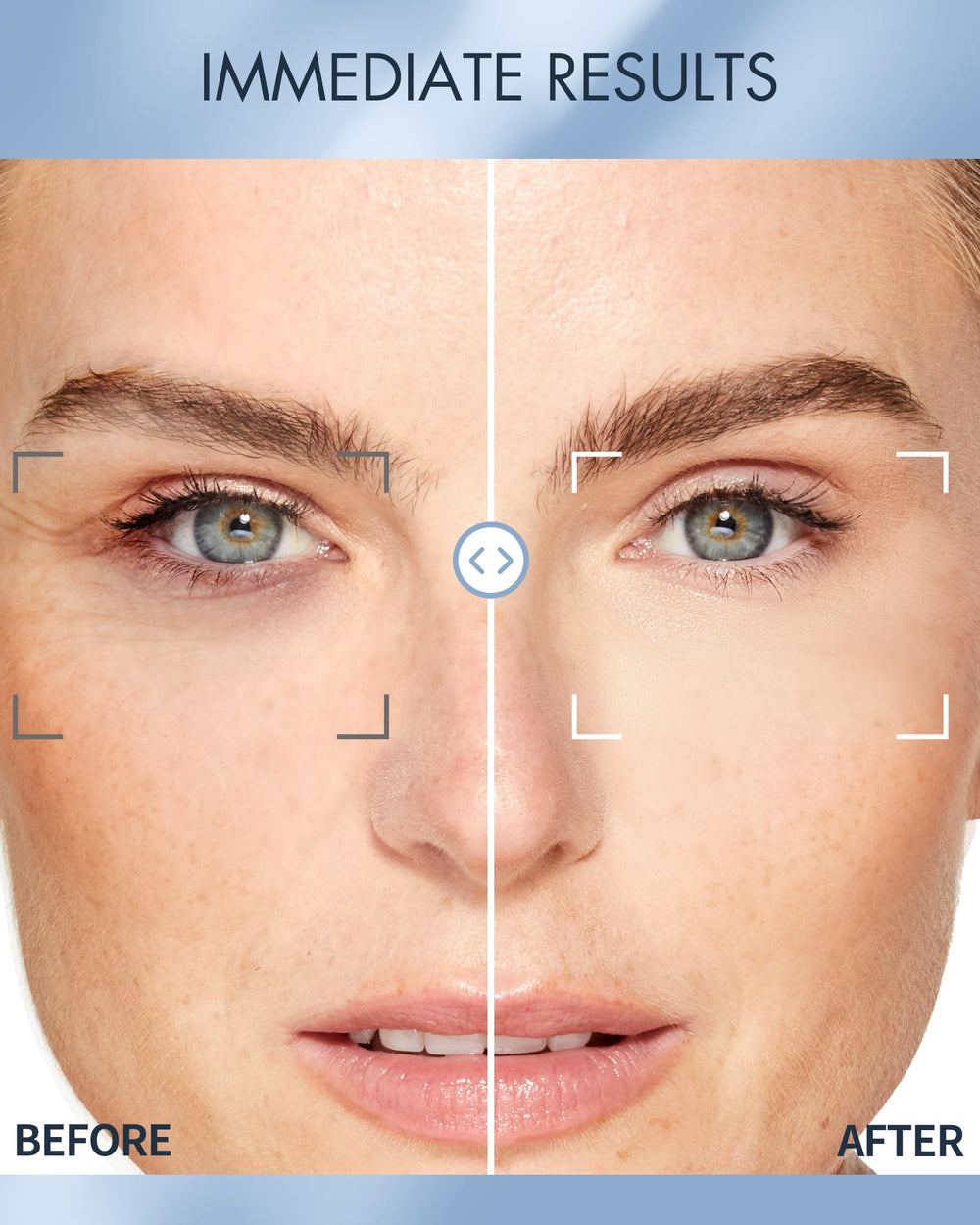Depology parches ojos hidrogel se adhieren suave al contorno para mejor contacto.