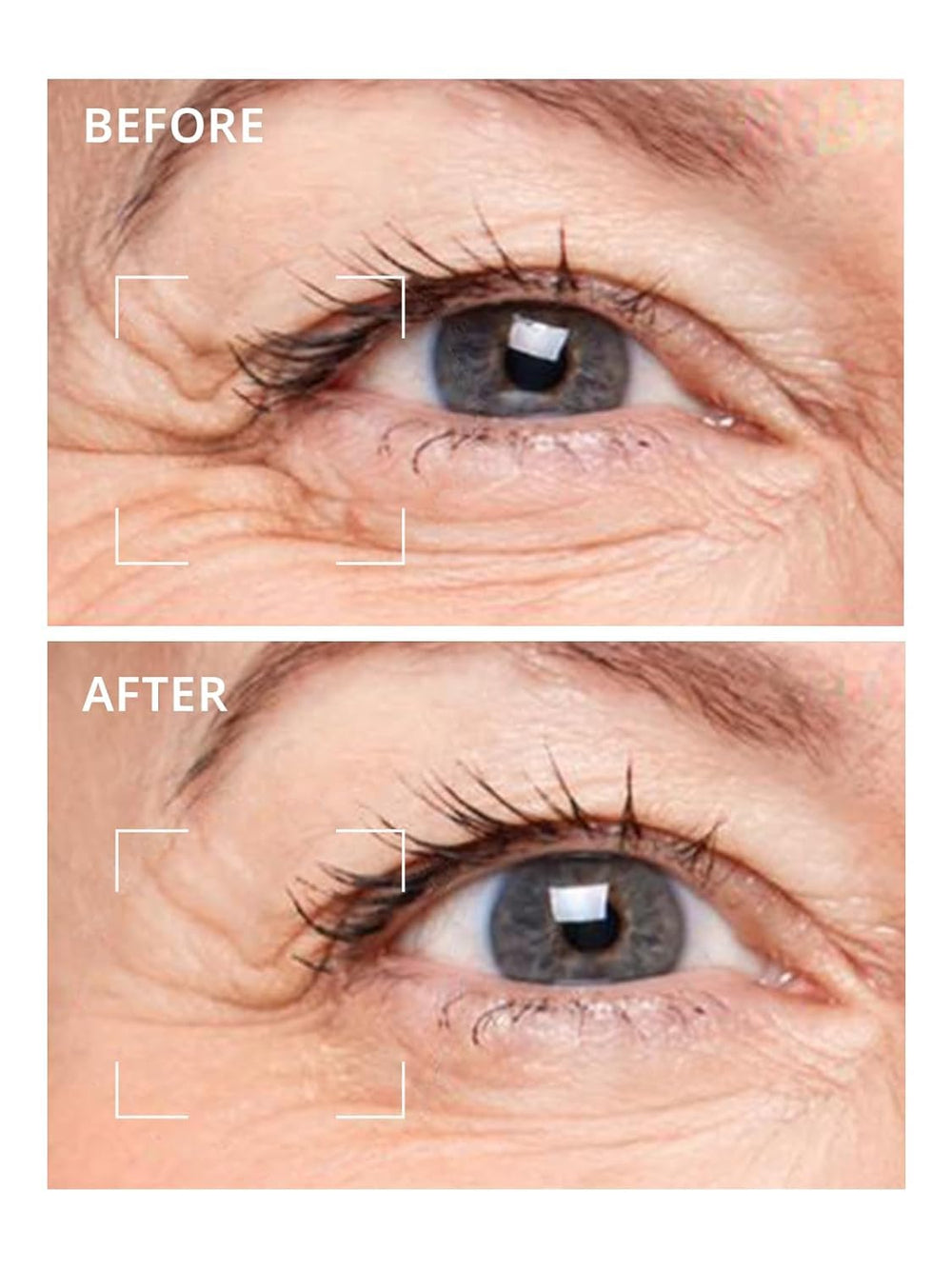Depology libera suero al contacto para cuidado cómodo de ojos.
