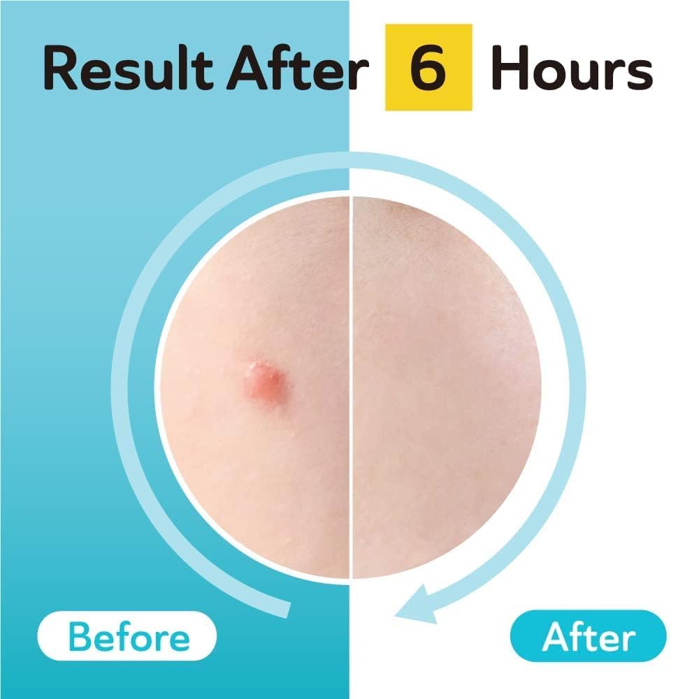 DERMA ANGEL parche con TXA para manchas posinflamatorias leves.