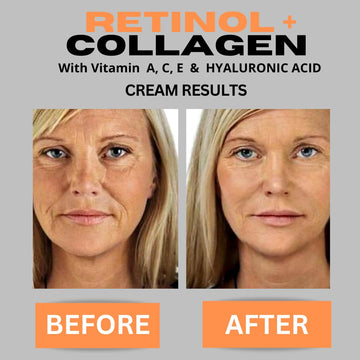 DERMA CLINICALS ácido hialurónico y vitamina C para hidratación y luminosidad