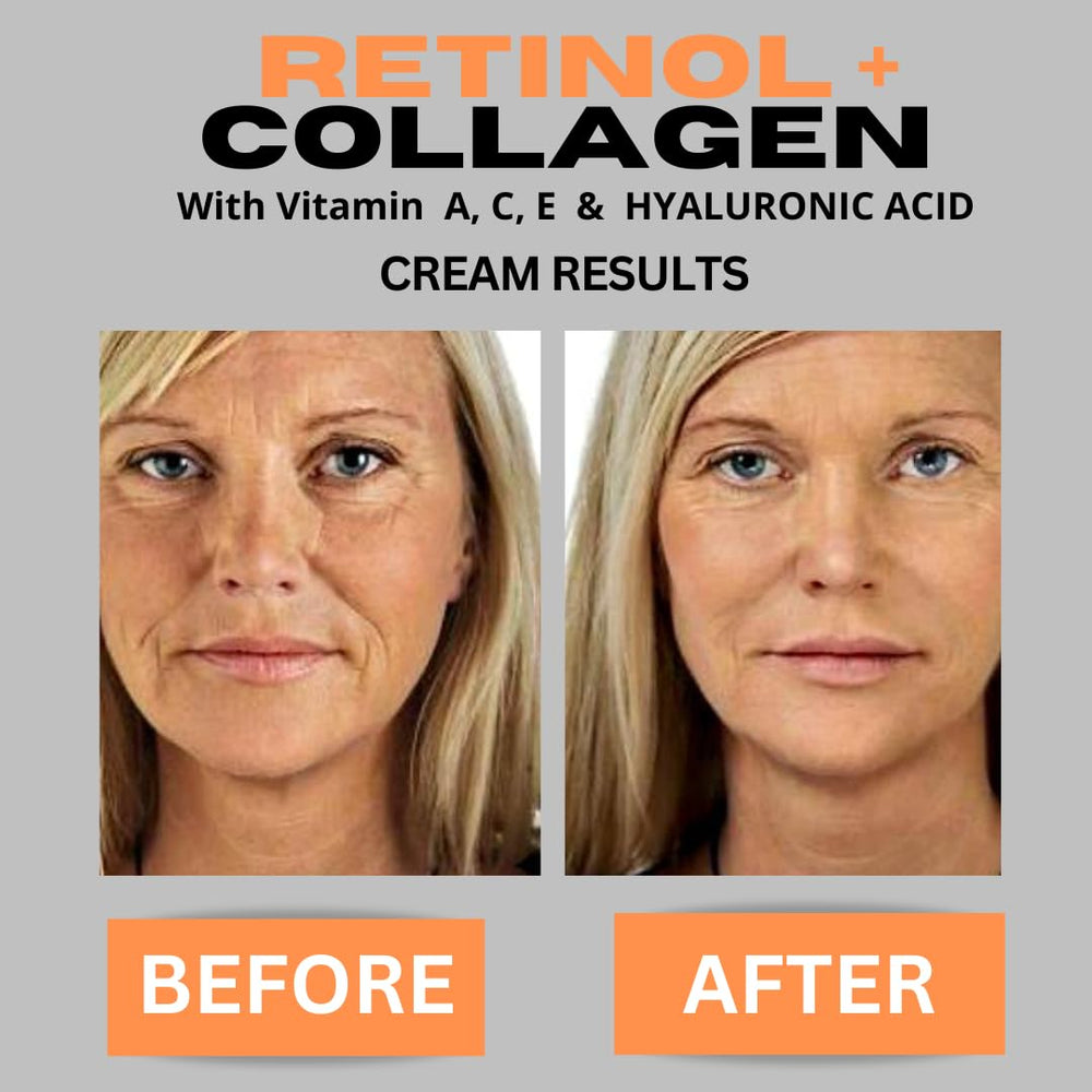 DERMA CLINICALS ácido hialurónico y vitamina C para hidratación y luminosidad