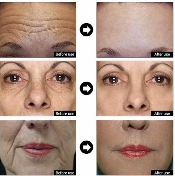 DERMA CLINICALS Sérum Hialurónico Nano, penetración profunda e hidratación intensa.