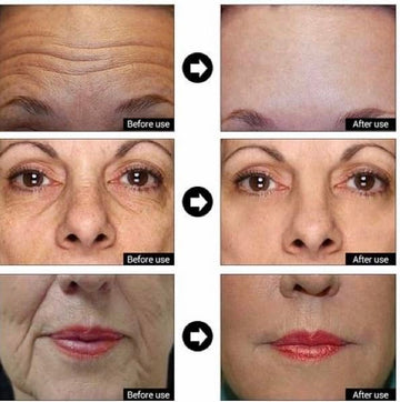 DERMA CLINICALS Sérum Hialurónico Nano, penetración profunda e hidratación intensa.