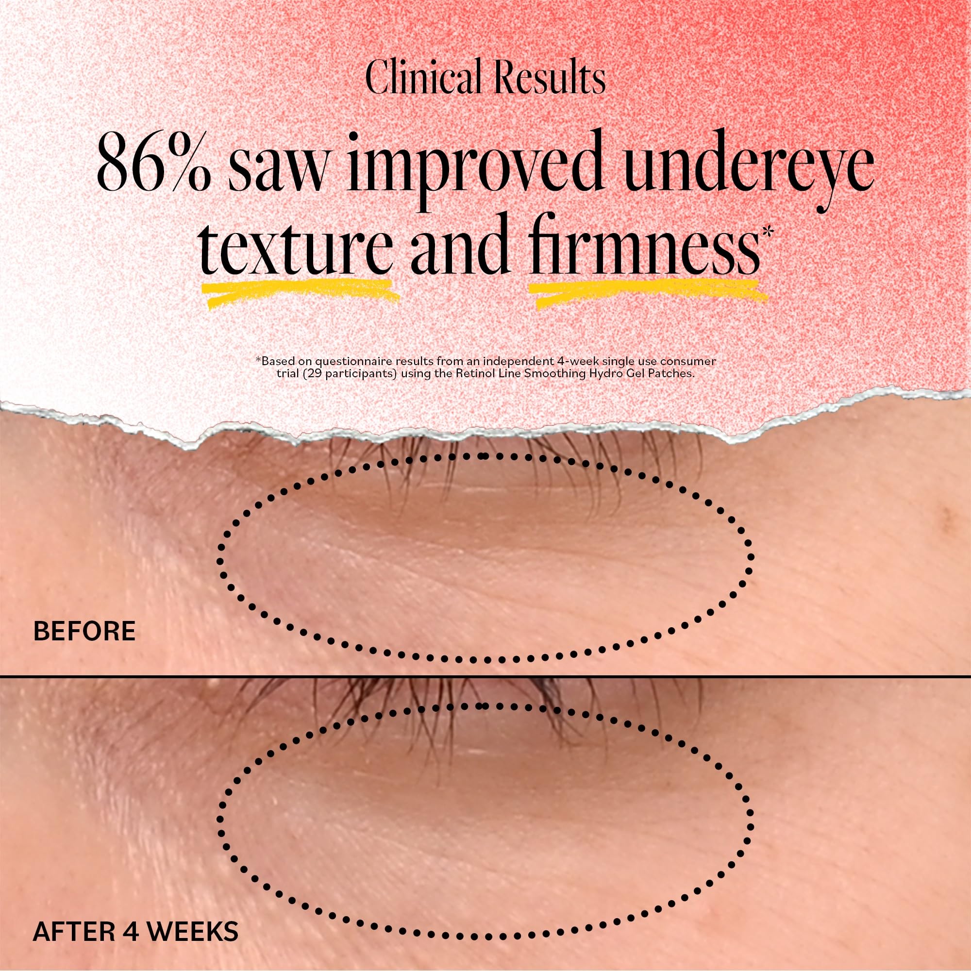 Patch hydrogel Derma E, détail de la texture rafraîchissante.