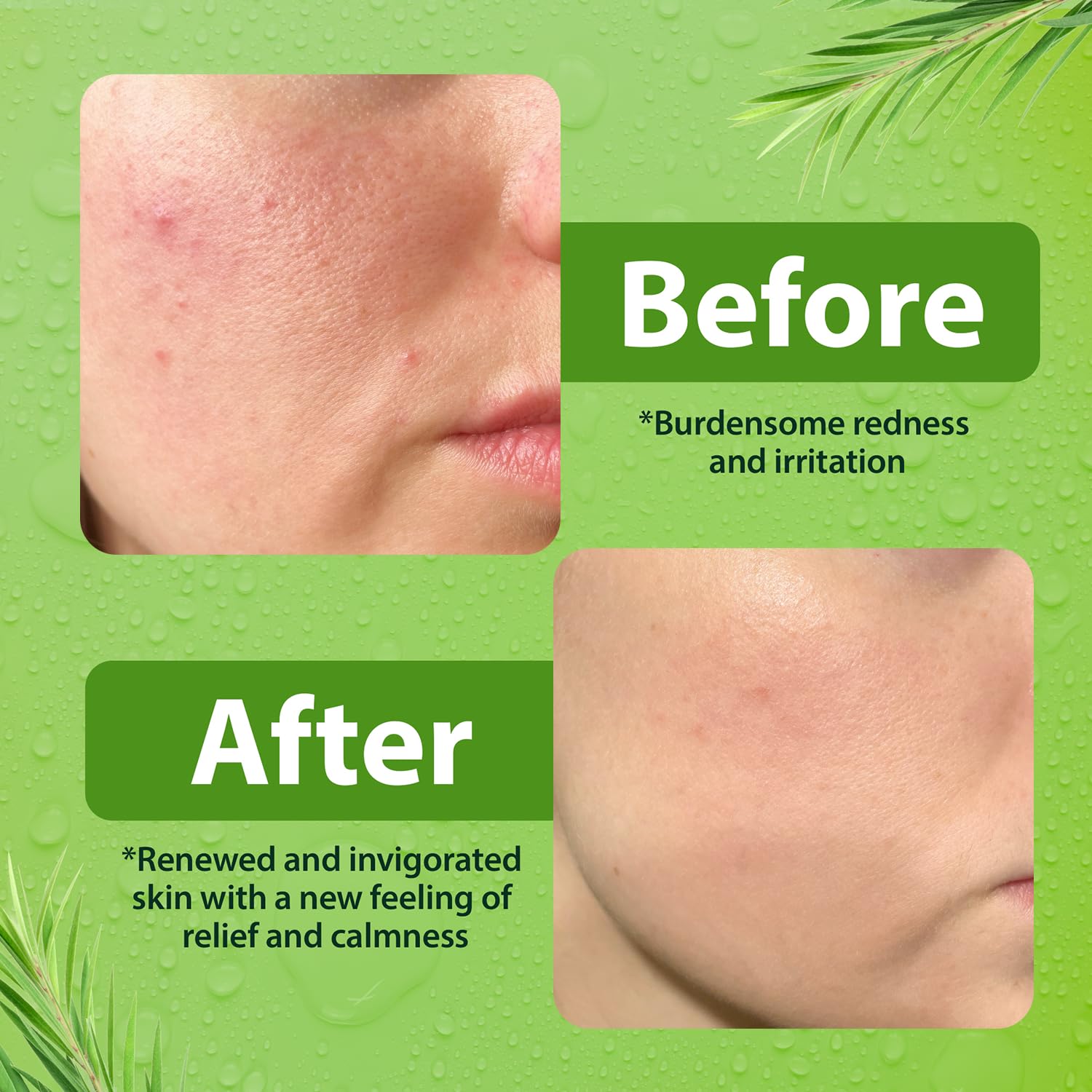 Derma-Nu para piel sensible, adecuado para uso diario suave.