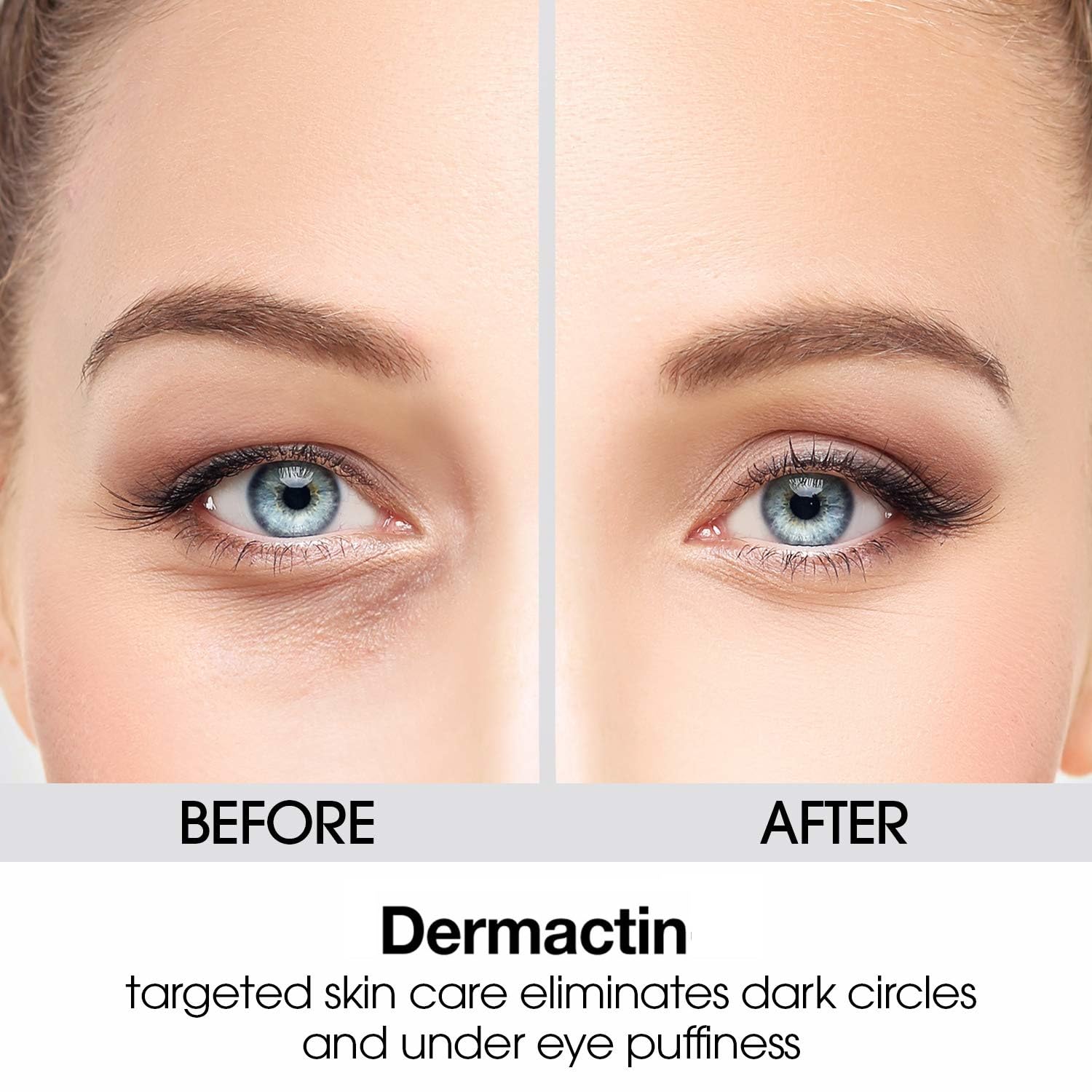 Dermactin tratamiento antiarrugas ojos, puede disminuir la profundidad de líneas finas.