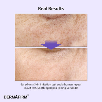 Dermafirm R4 aplicación manual para hidratar y calmar la piel