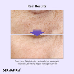 Dermafirm R4 aplicación manual para hidratar y calmar la piel