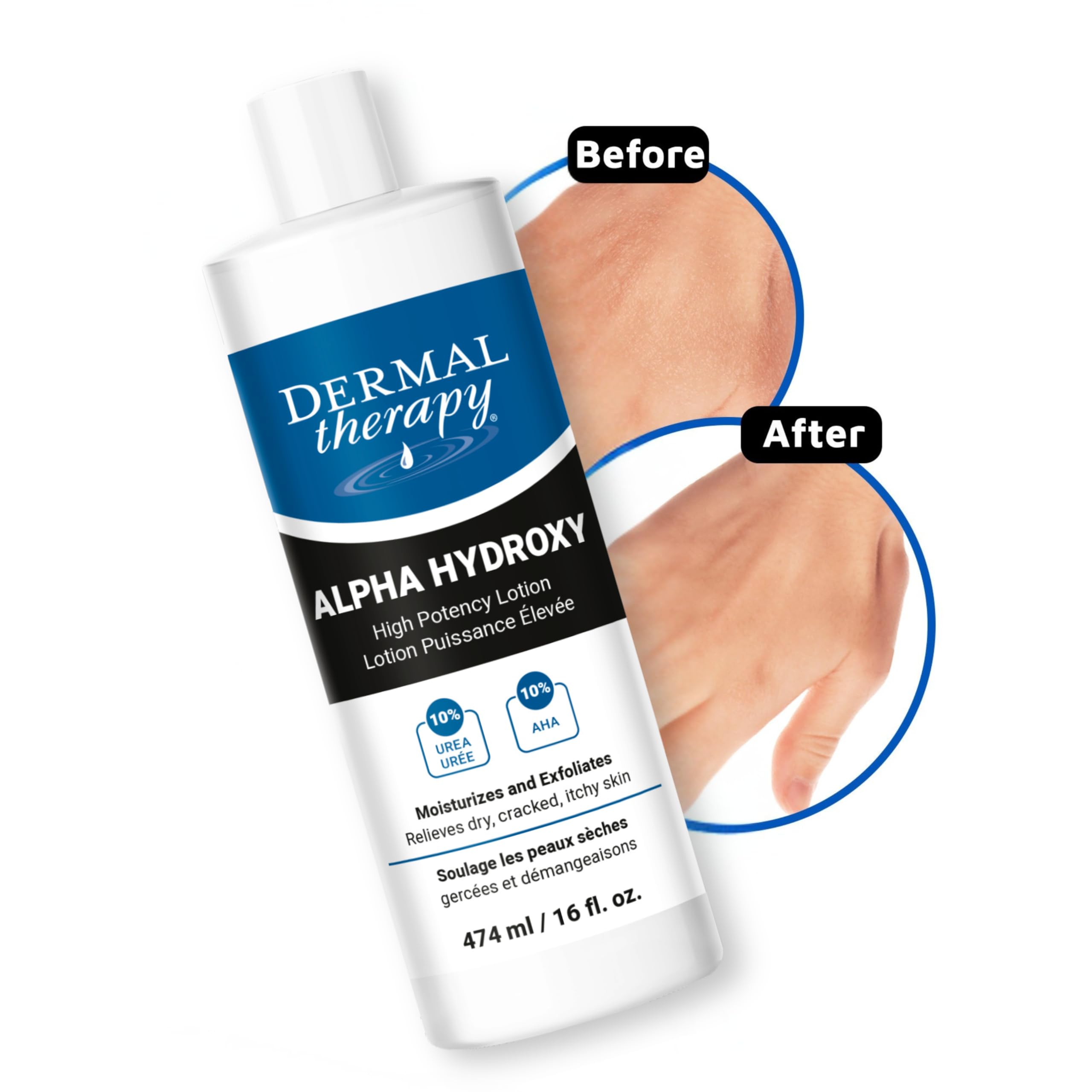 Dermal Therapy piel seca con uso diario.