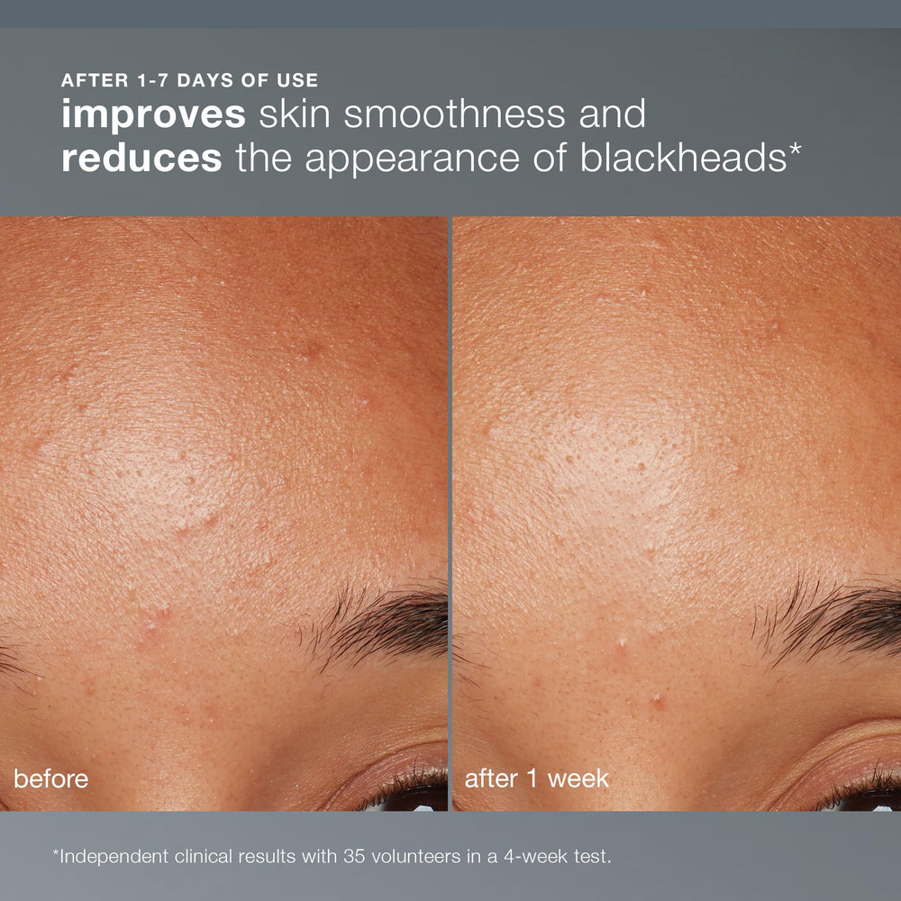 Dermalogica Daily Microfoliant, aplicación diaria suave, ideal para antes del maquillaje