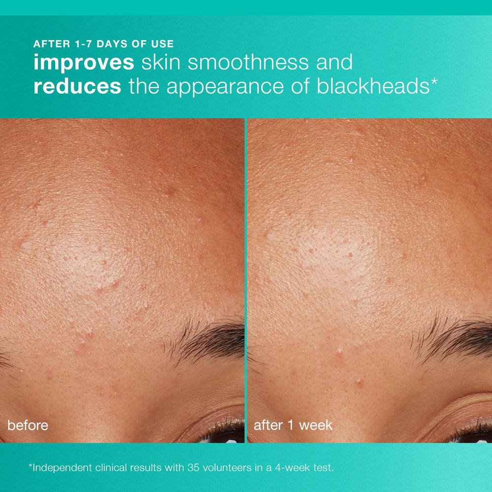 Dermalogica kit envase viaje, formato compacto para viajar