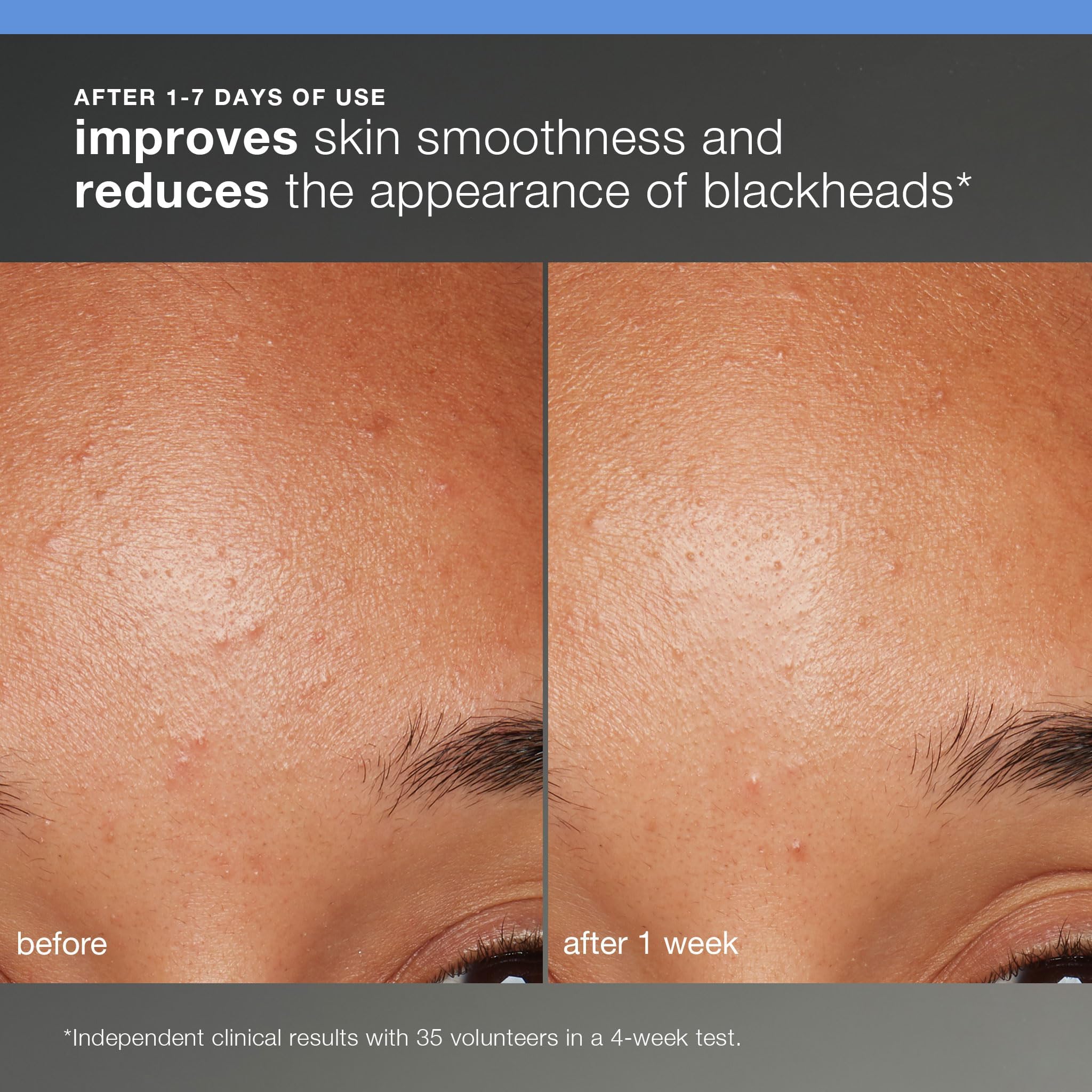 Dermalogica kit piel saludable introducción para todo tipo de piel