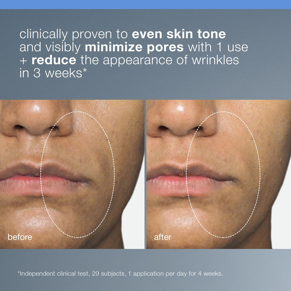 Dermalogica peeling líquido, aplicación nocturna suave sobre la piel para claridad gradual.