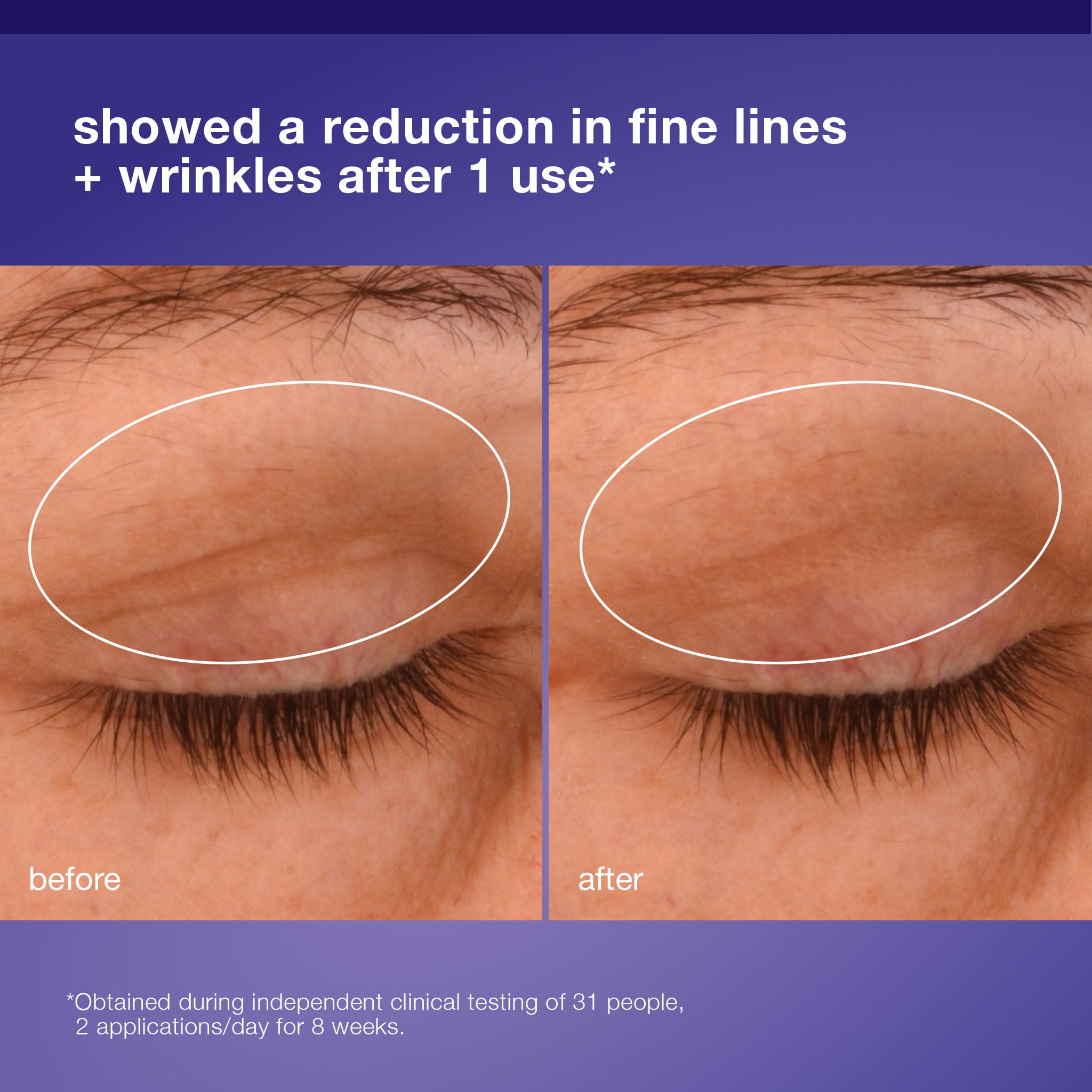 Dermalogica Phyto Nature Lifting, squalane para suavidad y calma en ojos.