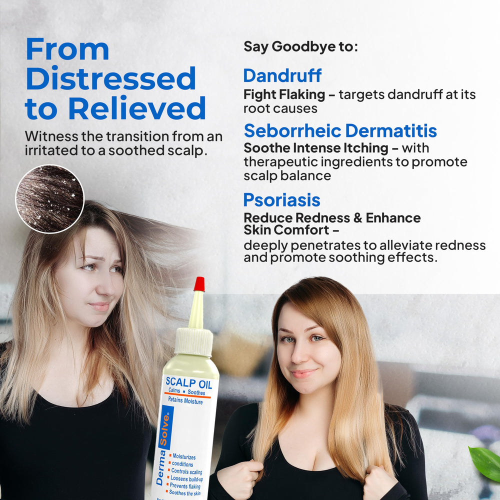 Dermasolve Calendula: hidratación para cuero cabelludo seco.