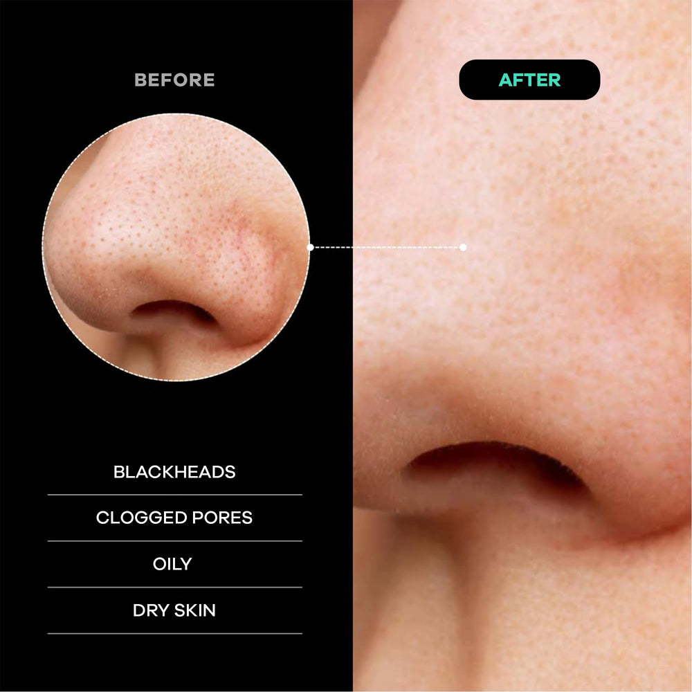 Dermasuri exfoliación de piel muerta en cuerpo para una piel más tersa