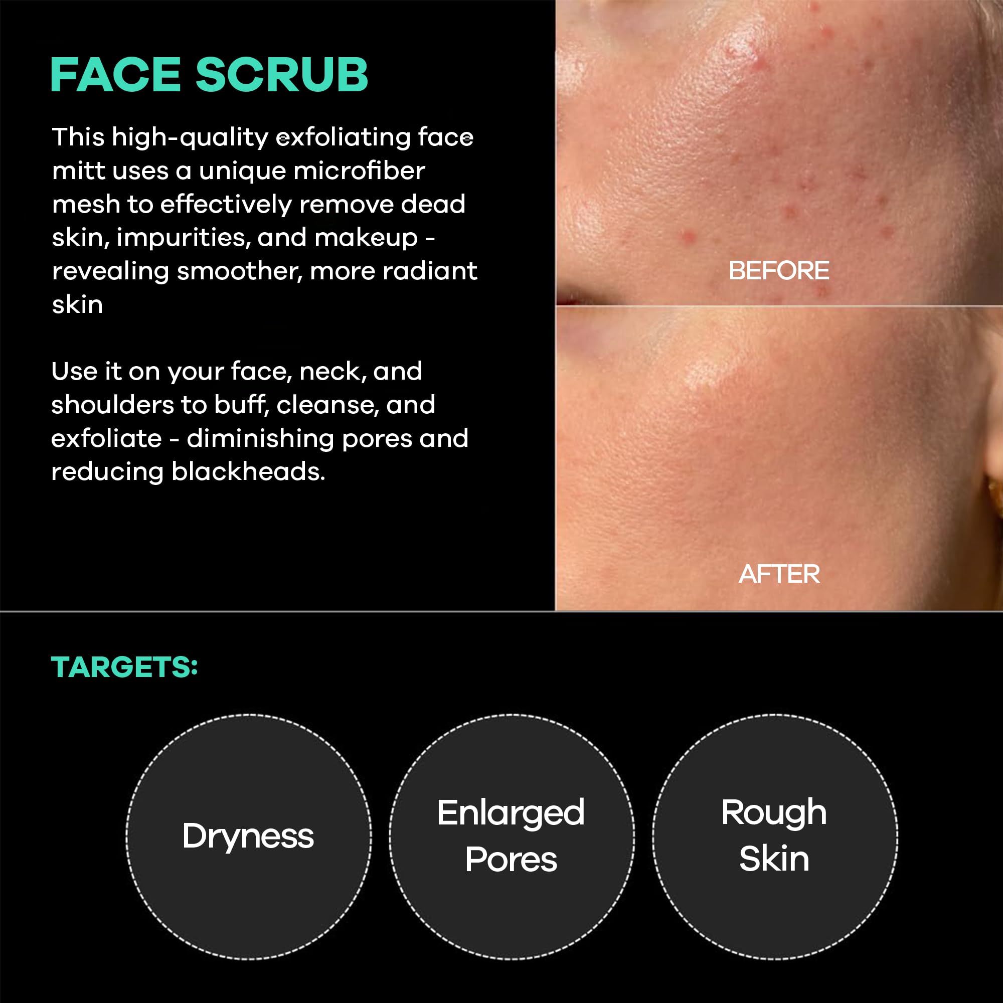 Dermasuri exfoliación de piel muerta en rostro mejora la textura de la piel