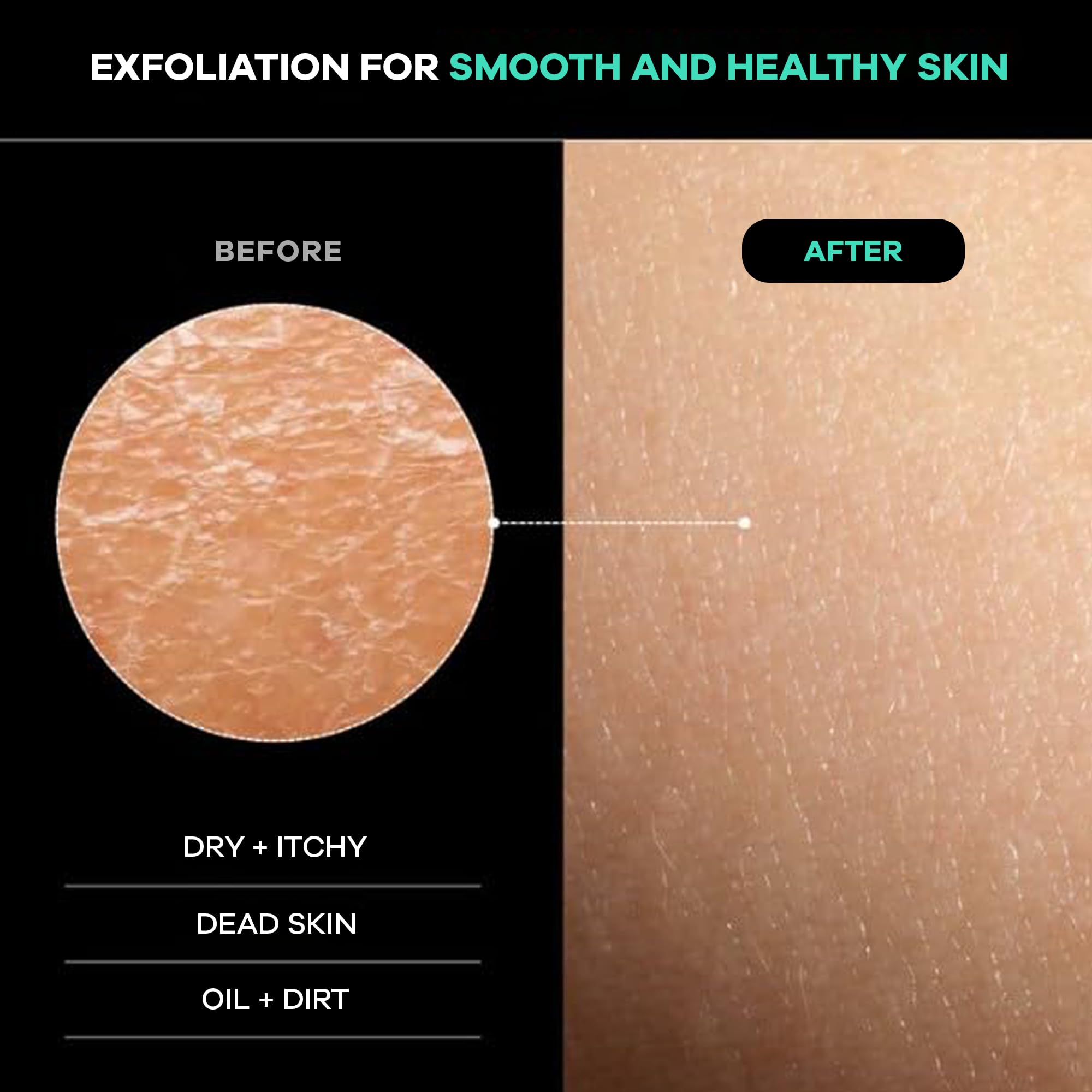 Dermasuri exfoliador de espalda con mango ergonómico para alcance