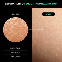 Dermasuri exfoliador de espalda con mango ergonómico para alcance