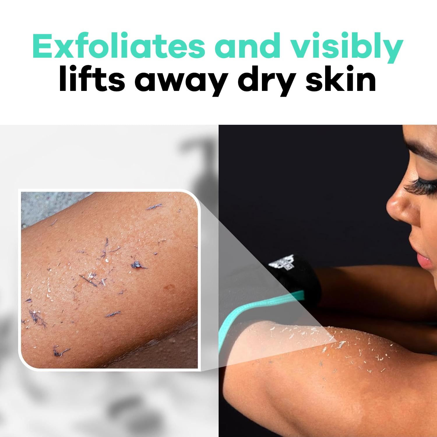 Guante exfoliante Dermasuri teal, muestra mejora visible de la piel.