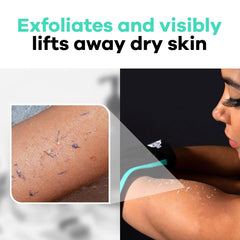 Guante exfoliante Dermasuri teal, muestra mejora visible de la piel.