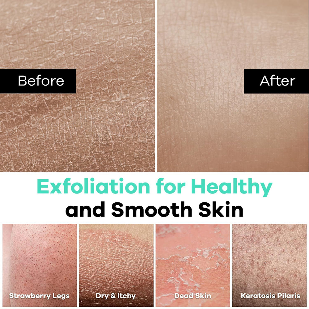 Guante Dermasuri exfoliante teal, reutilizable tras enjuague para cuidado diario.