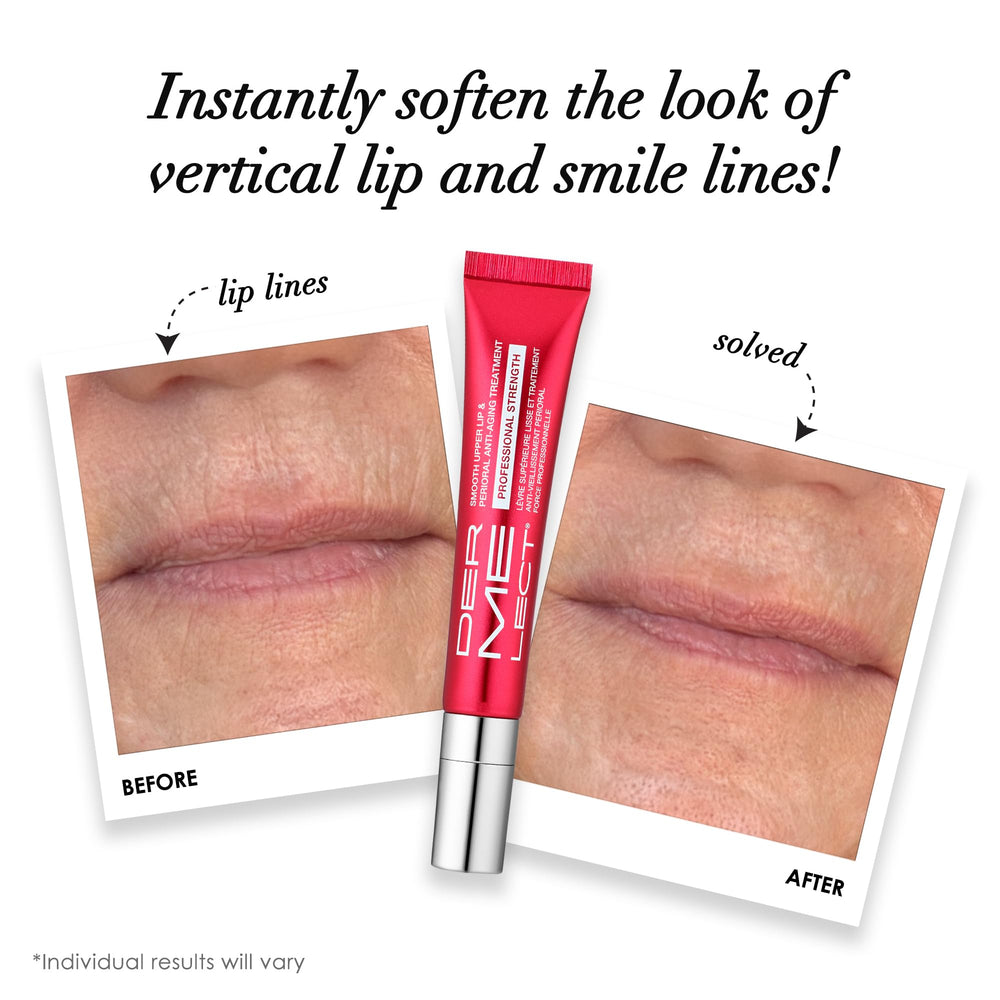 Dermelect Smooth Upper Lip envase portatil para retoques rapidos