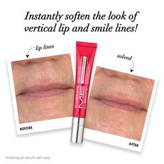 Dermelect Smooth Upper Lip envase portatil para retoques rapidos