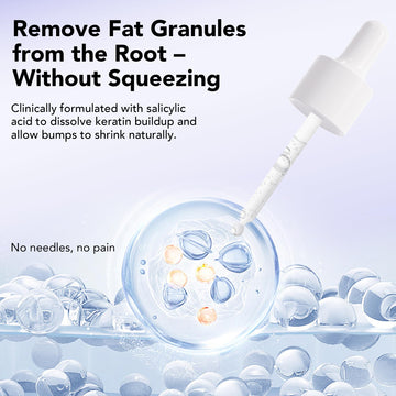 DERMFREE Milia Remover aplicación cercana al ojo para uso diario