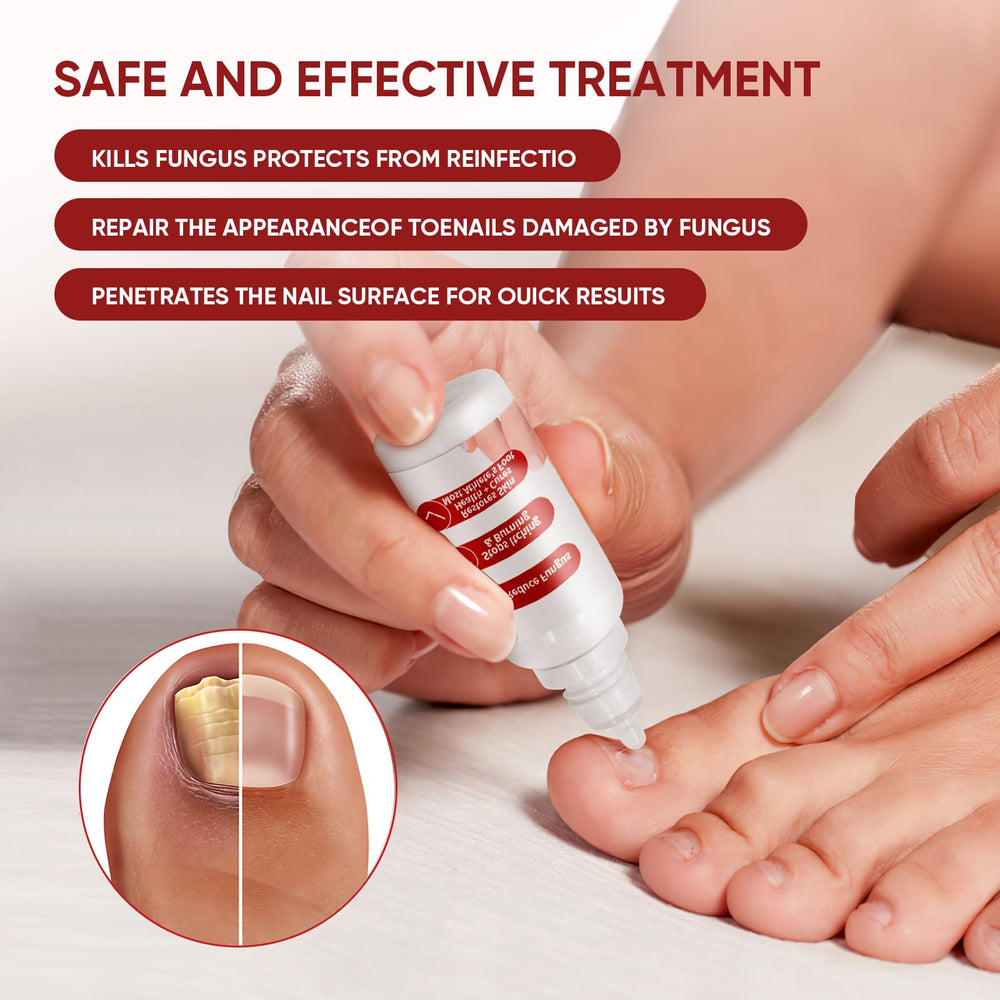 DERMFREE mejora el aspecto de uñas antes del tratamiento