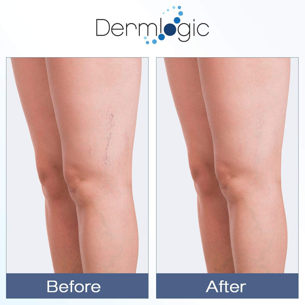 Dermlogic Vitamine K Crème cernes et poches: soutien potentiel contre les signes de fatigue.