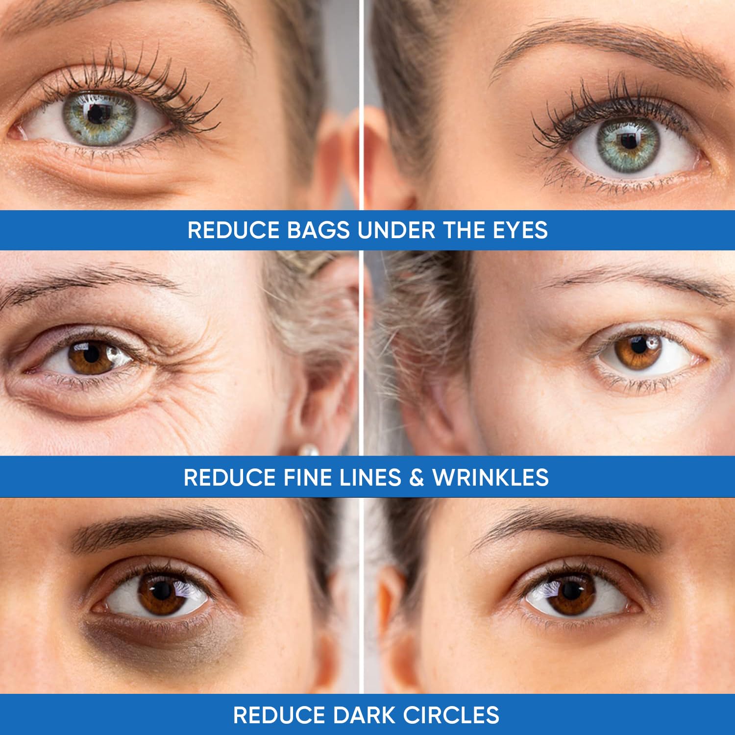 Dermlogic instant tightening under-eye area after one application