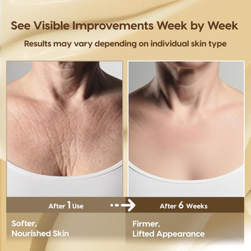 DERPHEA Crepey Skin Repair aplicación en brazo, mejora la hidratación diaria.